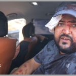 Palestinians and US journalist injured by Israeli settlers in West Financial institution harvest assault